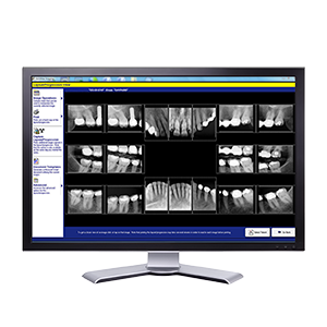 Digital Dental Xrays in Charlottle NC