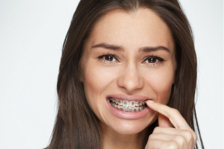 young woman picking food out of her braces